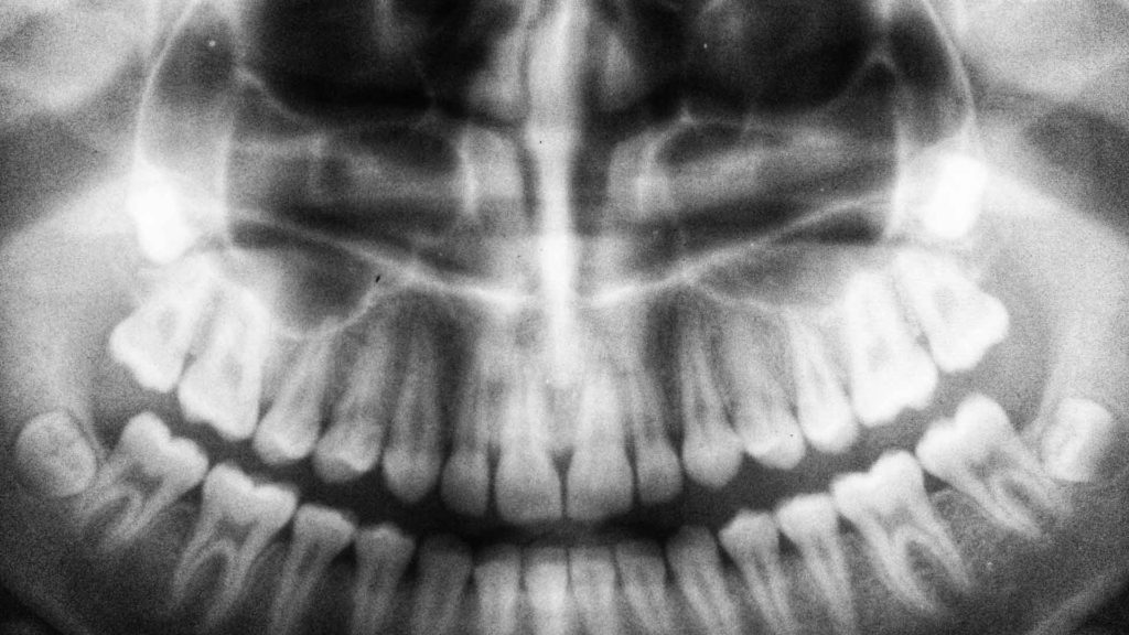 CT-Scan-Basic-on-HomeTalk